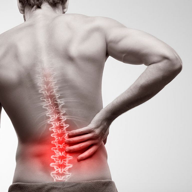 Lumbalgia: tratamiento del dolor de espalda inferior
